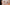 Woman suffering from COVID-related hair loss holding hair clumps