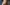 Woman smiling after combatting hair loss with stem cell serum